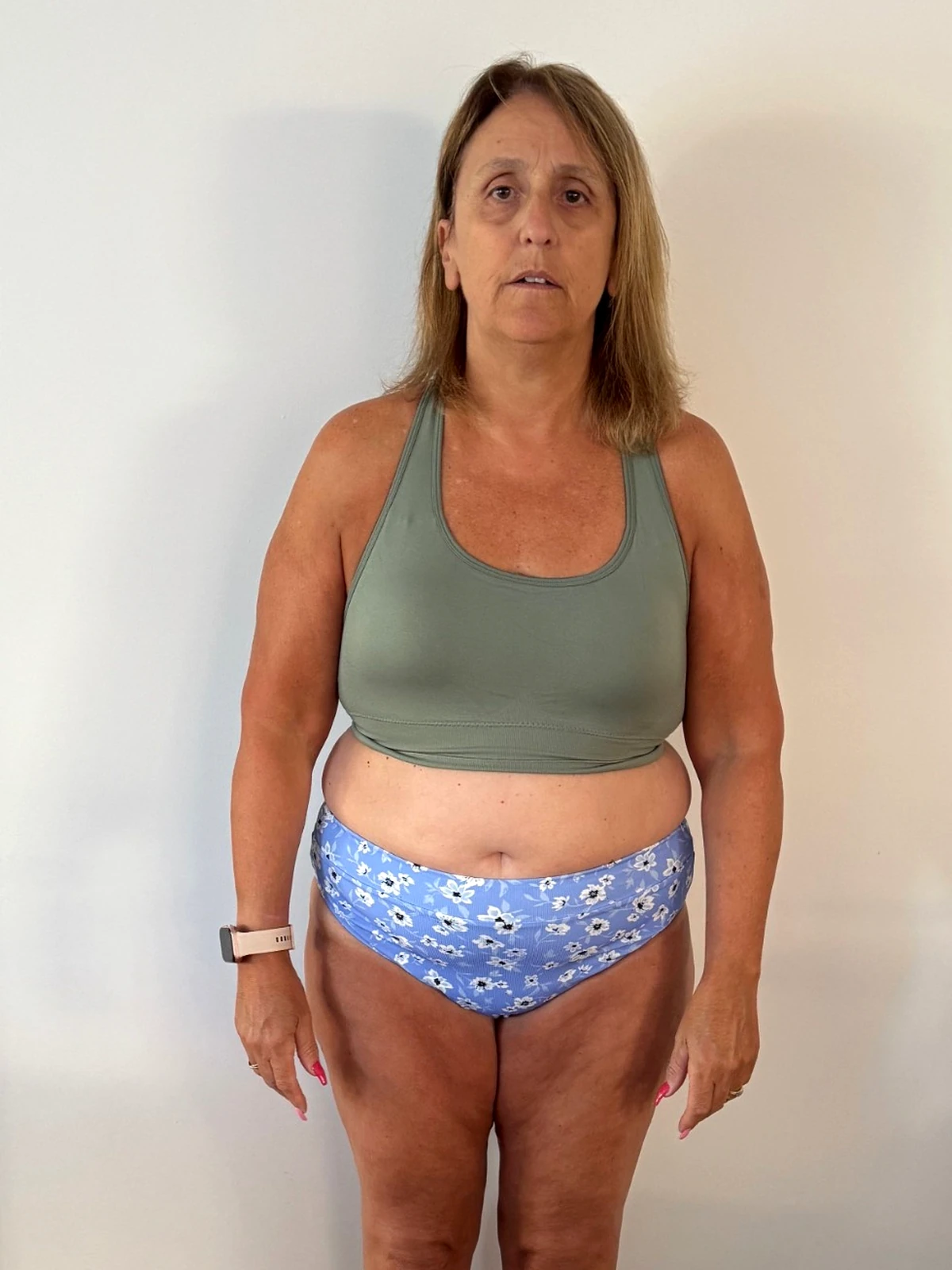 Vikki Milroy before